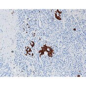 Synaptophysin
